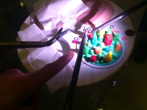 The surgeons finger to give me some scale!